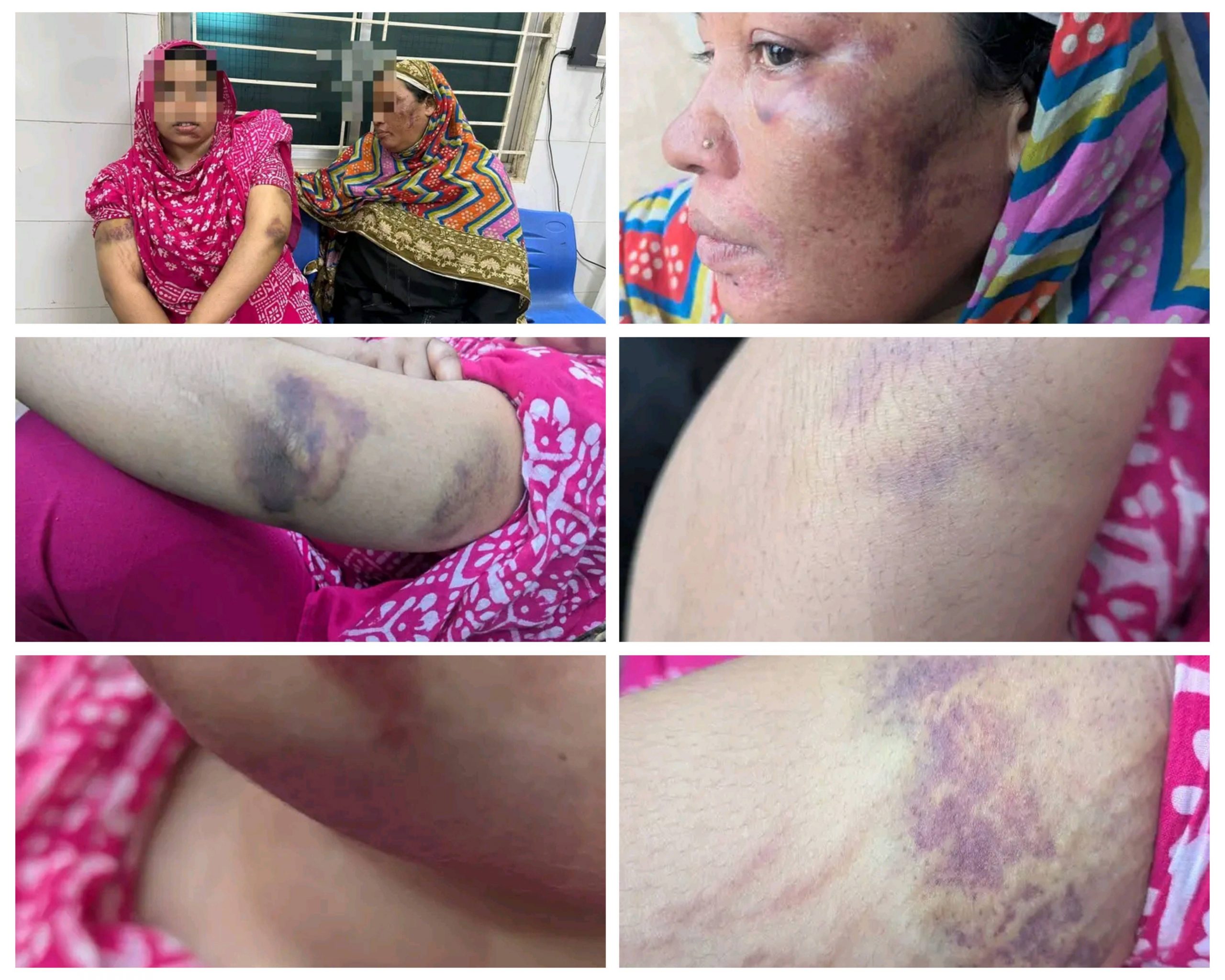 পেকুয়ায় পুলিশি নির্যাতনের অভিযোগ: মা–মেয়েকে মারধর করে জেলে পাঠানোর ঘটনায় আইনি প্রশ্ন